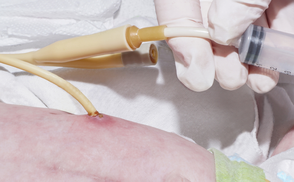 Capacitación en Domicilio Cuidados para Gastrostomía